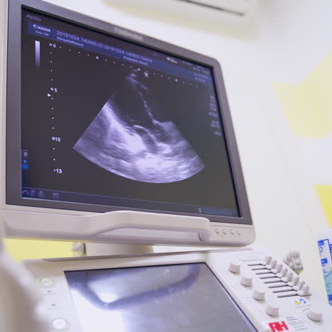 panning shot of modern ultrasound machine. screen of ultrasound machine for diagnostics in healthcare at the medical centre.