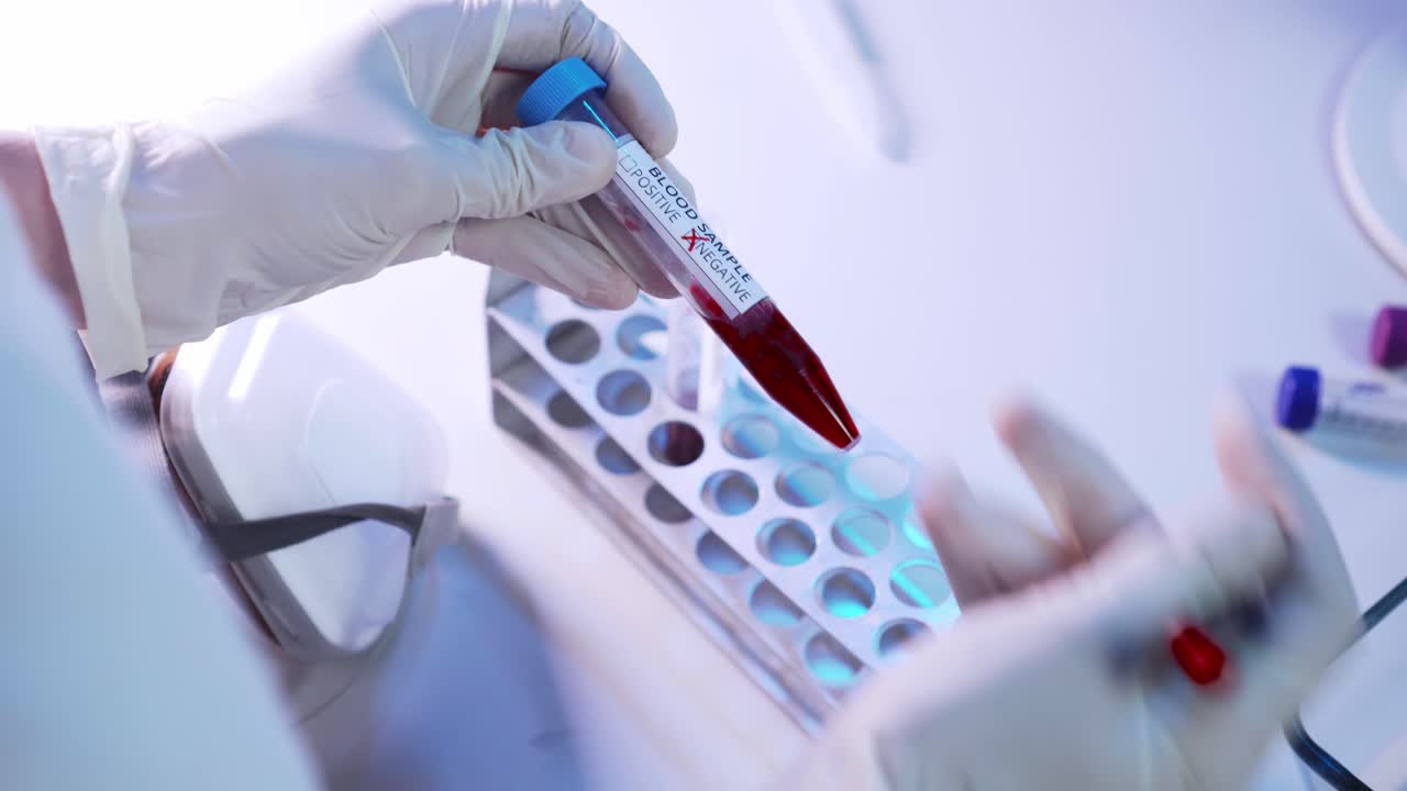 Picking up blood sample in test tube and marking it with marker in hand, closeup view