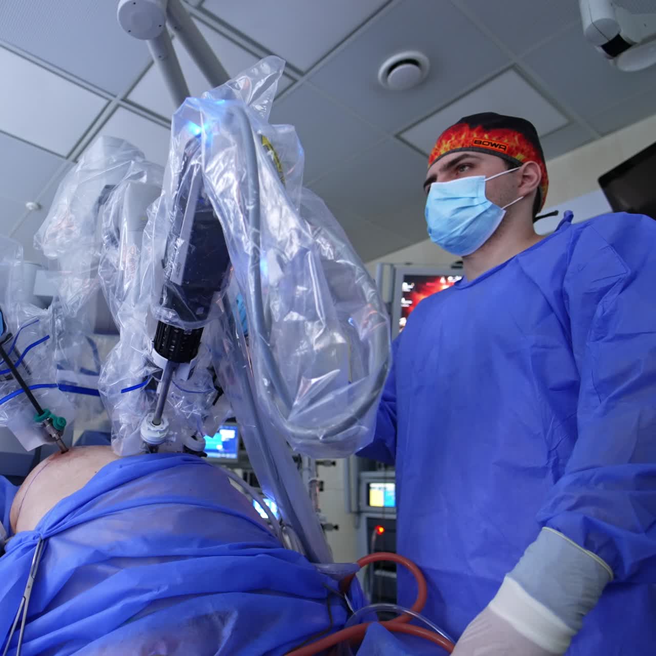 Patient on the operational table is undergoing laparoscopy. Procedure is conducted by the robotic surgery system. Doctor is watching the operation
