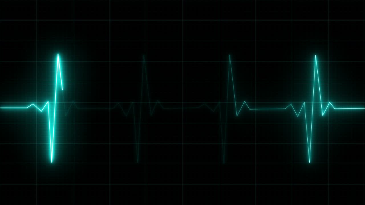 심장 박동 모니터, 심장 전기 그래프 (ecg) 또는 ecg 루핑 배경