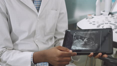 doctor reviewing ultrasound scan of a fetus
