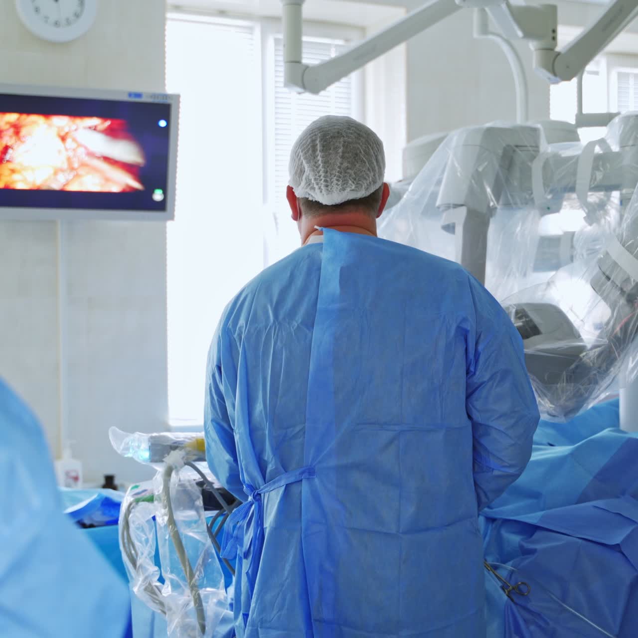 Robotic operation with minimally invasive involve. Operation by laparoscopic method with output of patient 's internal organs to the monitor. Doctors look at the monitor during surgery.