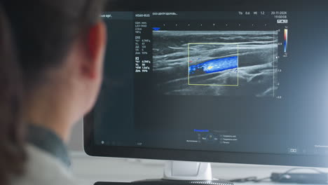 female lab researcher attentively observes imaging device displaying detailed color-coded ultrasound scan, focusing on medical analysis of patient internal structures with professional concentration