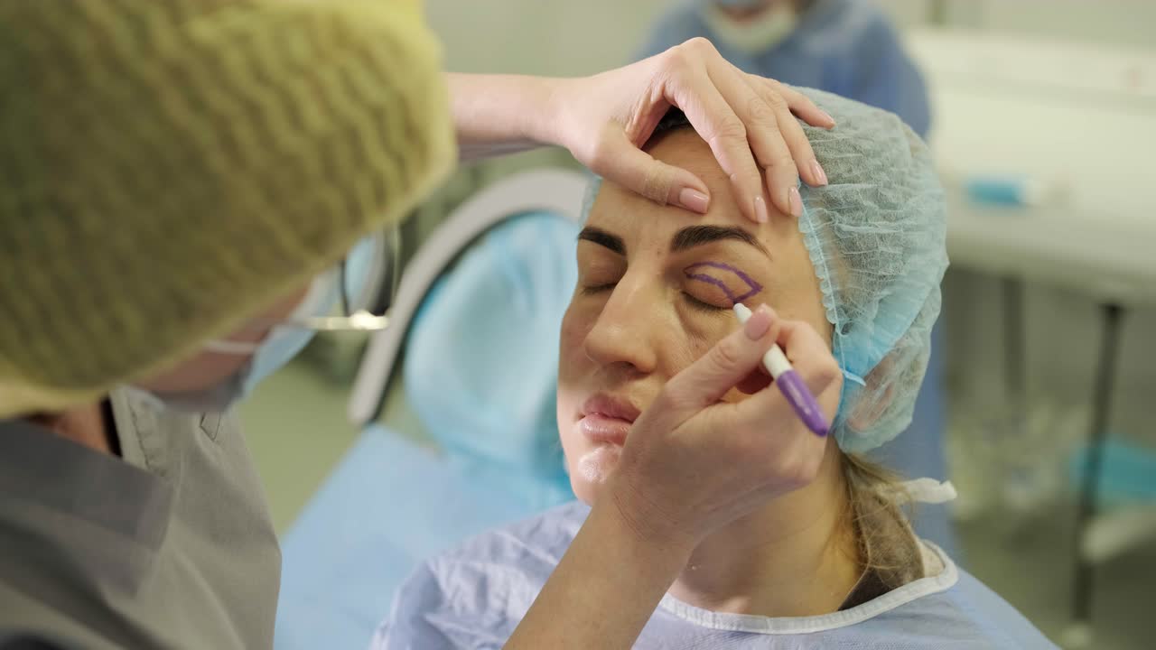 Operación de cirugía plástica de blefaroplastia, centrada en el rejuvenecimiento y la modificación de la región ocular