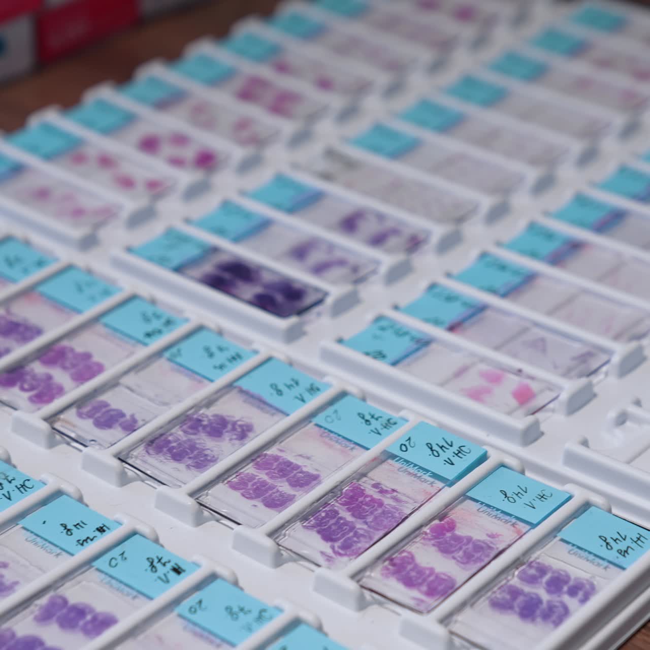 Test samples in medical laboratory. Test samples of blood putting on the special glasses. Medicine concept