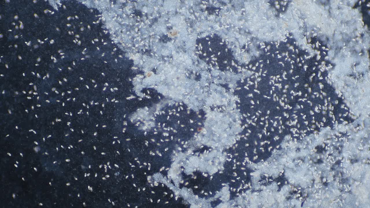 미생물 섬모 및 조류 고농도 현미경 암시야 보기