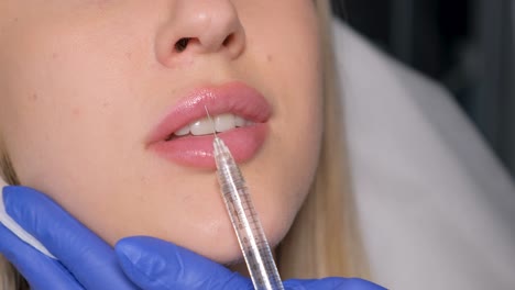 lip filler procedure