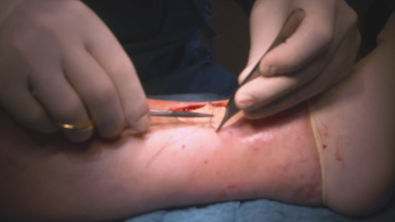 의사가 수술을 하다