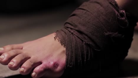 a close-up of a bandaged foot showing signs of injury, highlighting the impact of wounds, treatment, and the resilience of the human body amidst challenging circumstances