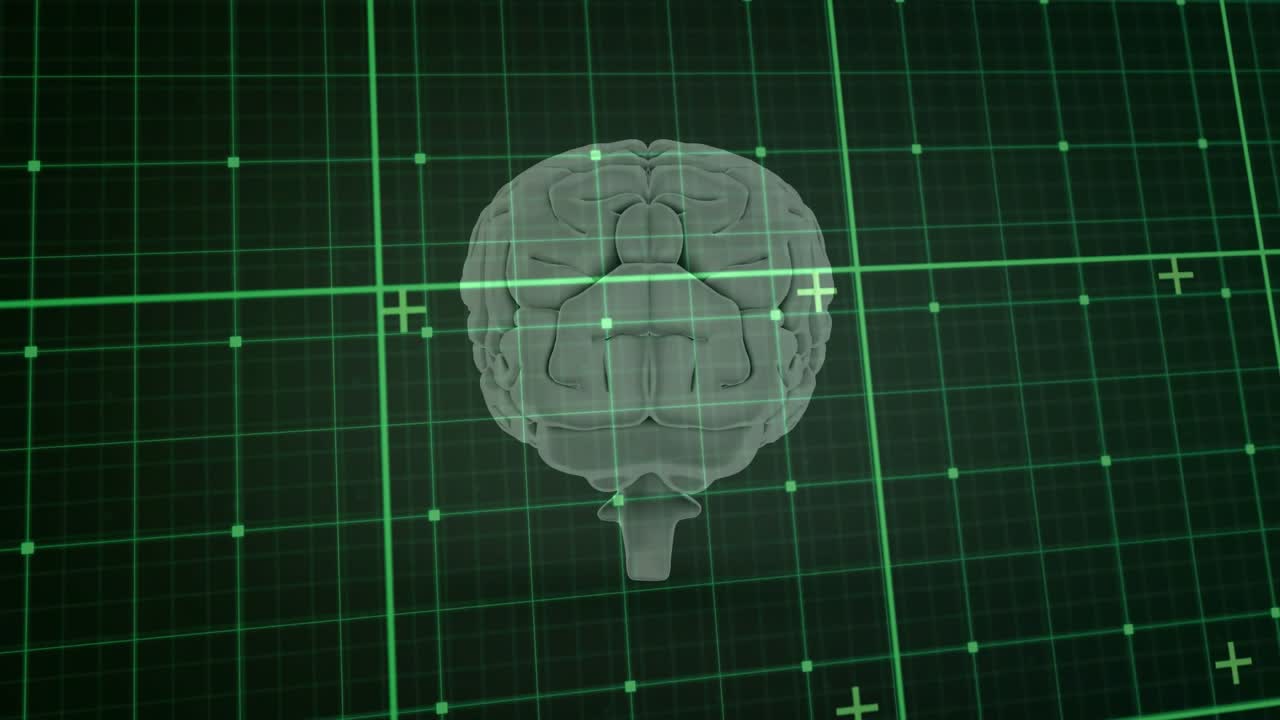 Modello di cervello che ruota in una griglia medica, all'avvio della scansione, con una linea che scorre allineando i nodi per la diagnosi.