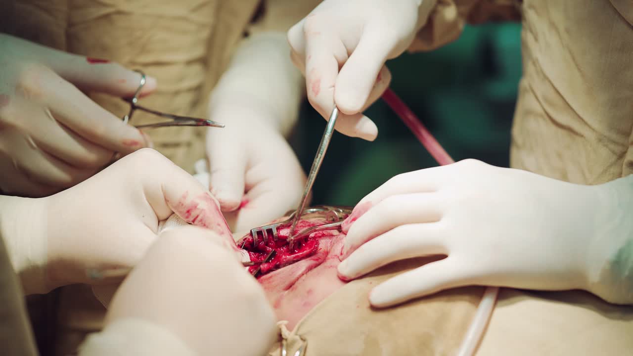 Close-up of the Surgeon's Hands and Instruments in the background of the Skull. Working with surgical instruments
