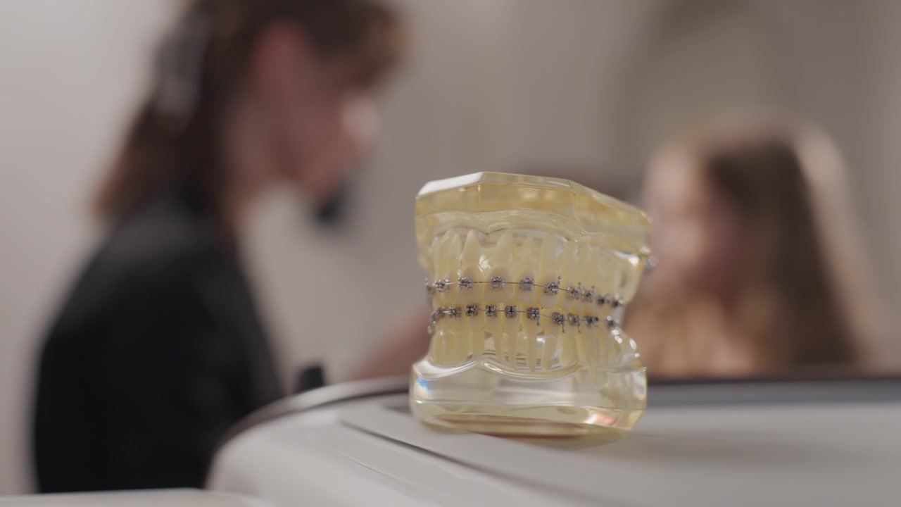 Primo piano di un modello dentale con apparecchio ortodontico a fuoco, mentre figure sfocate e un ambiente clinico sono visibili. La scena mostra denti in plastica trasparente in esposizione che evidenziano i dettagli del trattamento ortodontico.