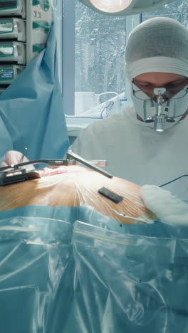 el médico hace cirugía cardíaca con herramientas en la clínica. el cirujano cardíaco cambia las pinzas por el bisturí láser trabajando en el pecho abierto del paciente en un centro médico especial