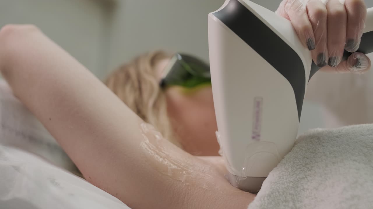 현대 화장품 클리닉에서 레이저 탈모 절차를 수행하는 여성의 팔꿈치 지역.