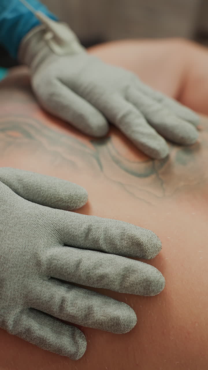 Massaggio con guanto a microcorrente sulla schiena, cliente uomo tatuato riceve trattamento non invasivo da estetista, guanti testurizzati guidano un elettrodo portatile sulla scapola mentre il cavo si collega al dispositivo.