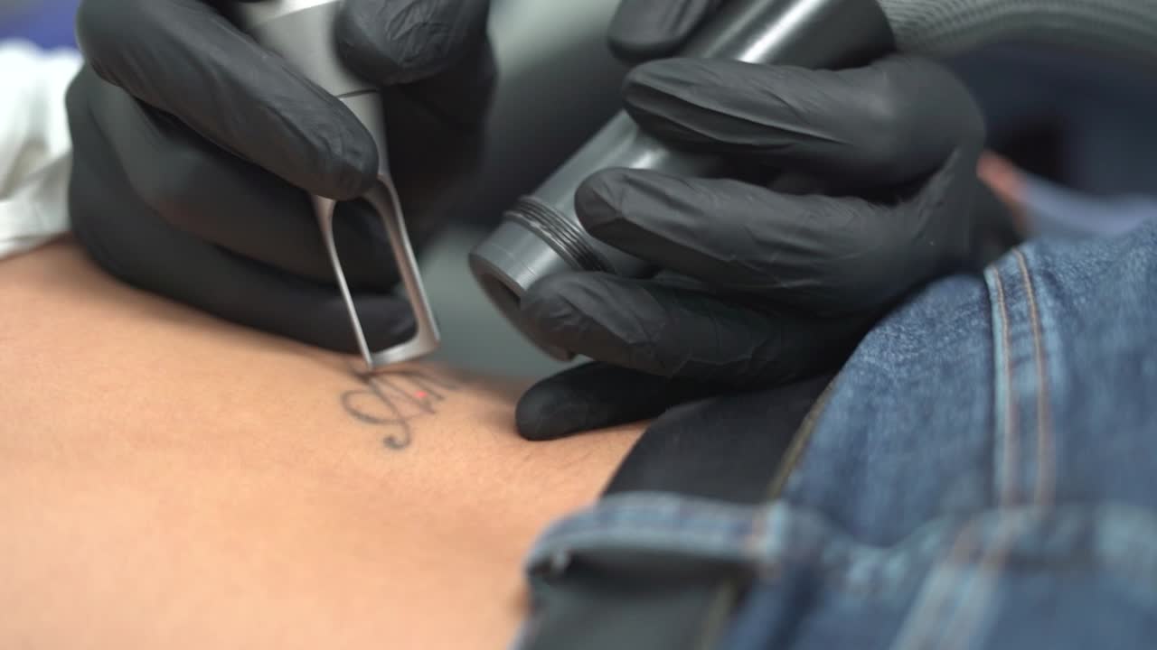 여성의 문신을 제거하거나 삭제하거나 지우십시오.