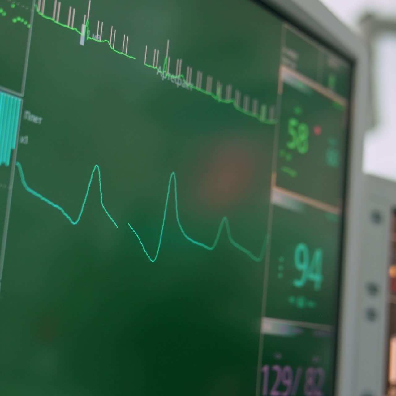Lines and numbers changing at the screen of medical equipment. Monitor controlling life signs of patient during operation. Close up