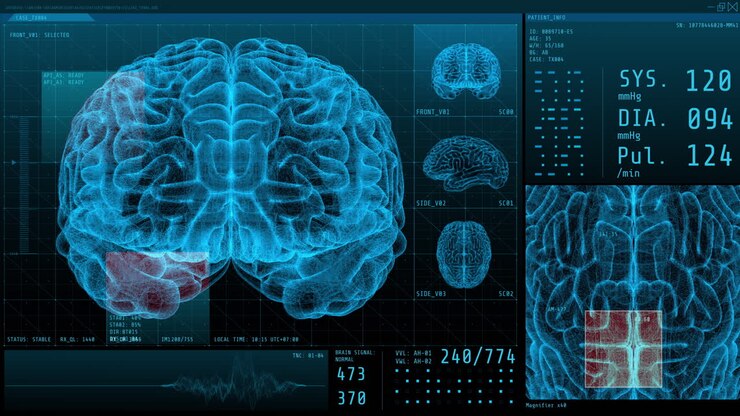 3D Brain Scan Visualization