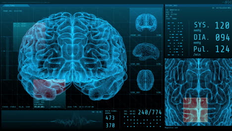 visualización de escaneo cerebral en 3d