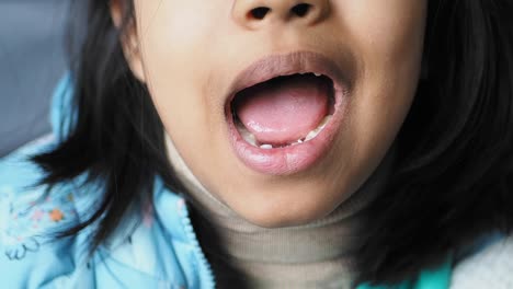 close-up of a young girl's mouth with missing teeth