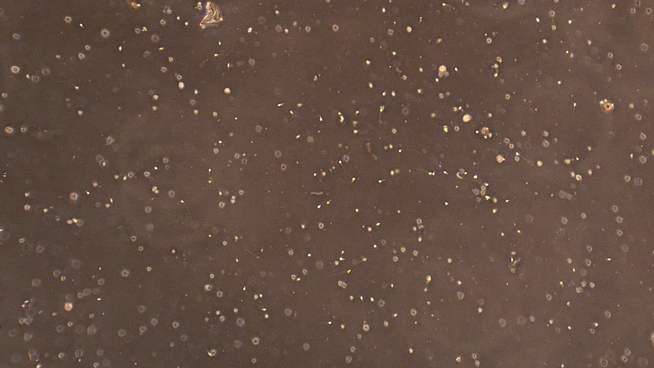 정액 속 에 헤엄치는 인간 정자 세포