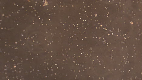 células espermáticas humanas nadando en el líquido seminal
