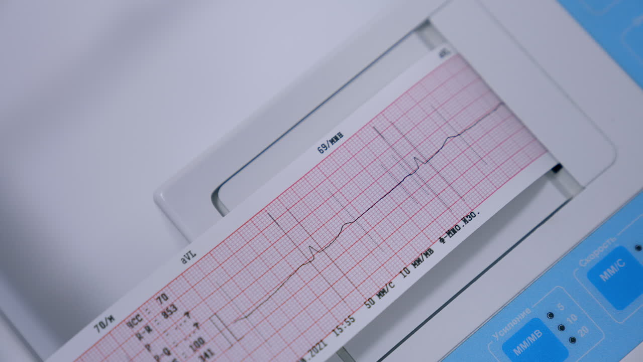 Examining heart rate and beat at medical equipment. Close up. Test result appearing on the special paper.
