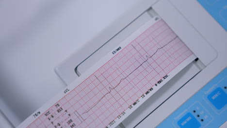 examining heart rate and beat at medical equipment. close up. test result appearing on the special paper.