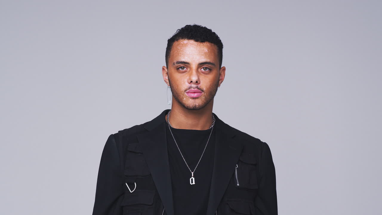 scatto in studio di un giovane con disturbo della pigmentazione della pelle che sorride alla telecamera in slow motion