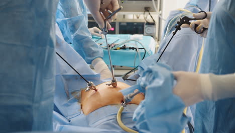 laparoscopic abdominal surgery