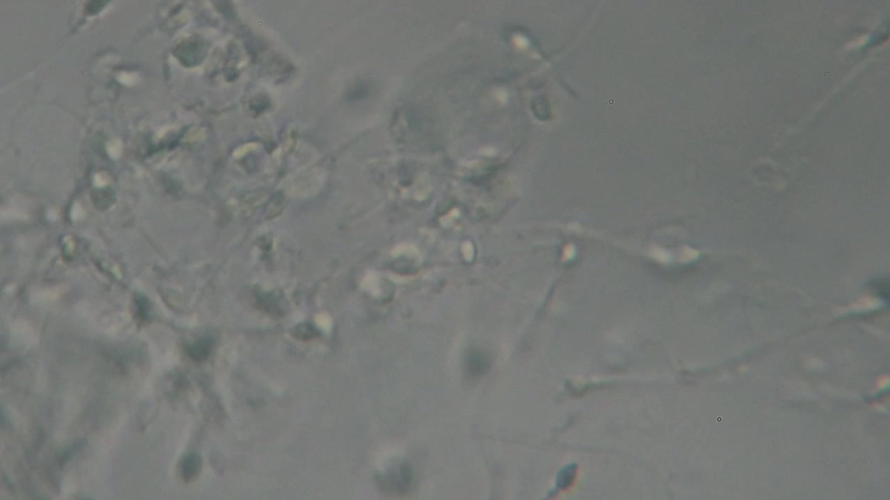 Microscopic view of moving human sperm cells with visible heads and flagella against a light background, commonly used in fertility and reproductive studies