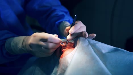 close up detail of eye surgery. surgeon hands in gloves performing laser eye vision correction