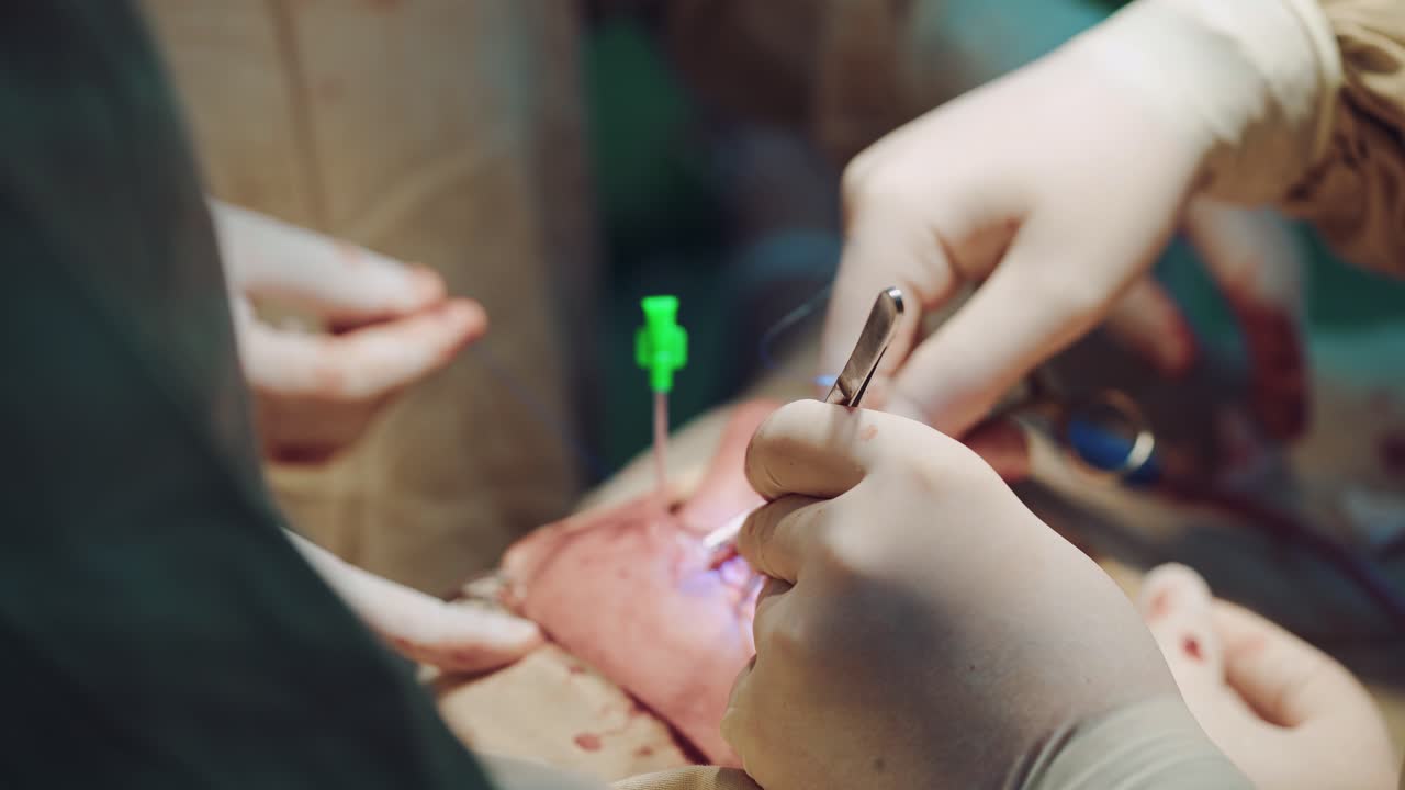 Close up of surgery team operating. Medical team of surgeons in hospital doing minimally invasive surgical interventions