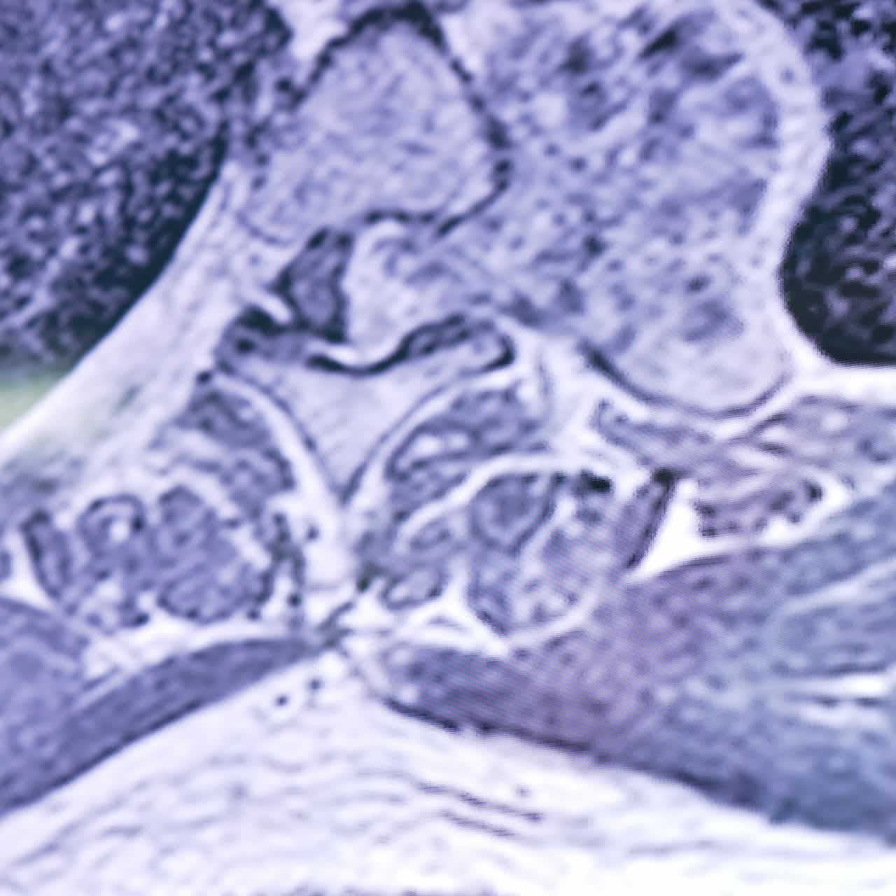 Monitor of MRI diagnostics of a patient. Spine and other parts of body on the screen close up