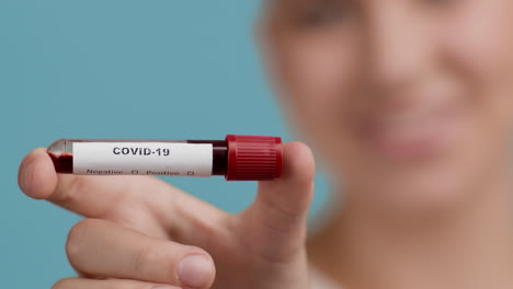 prueba de sangre para covid-19
