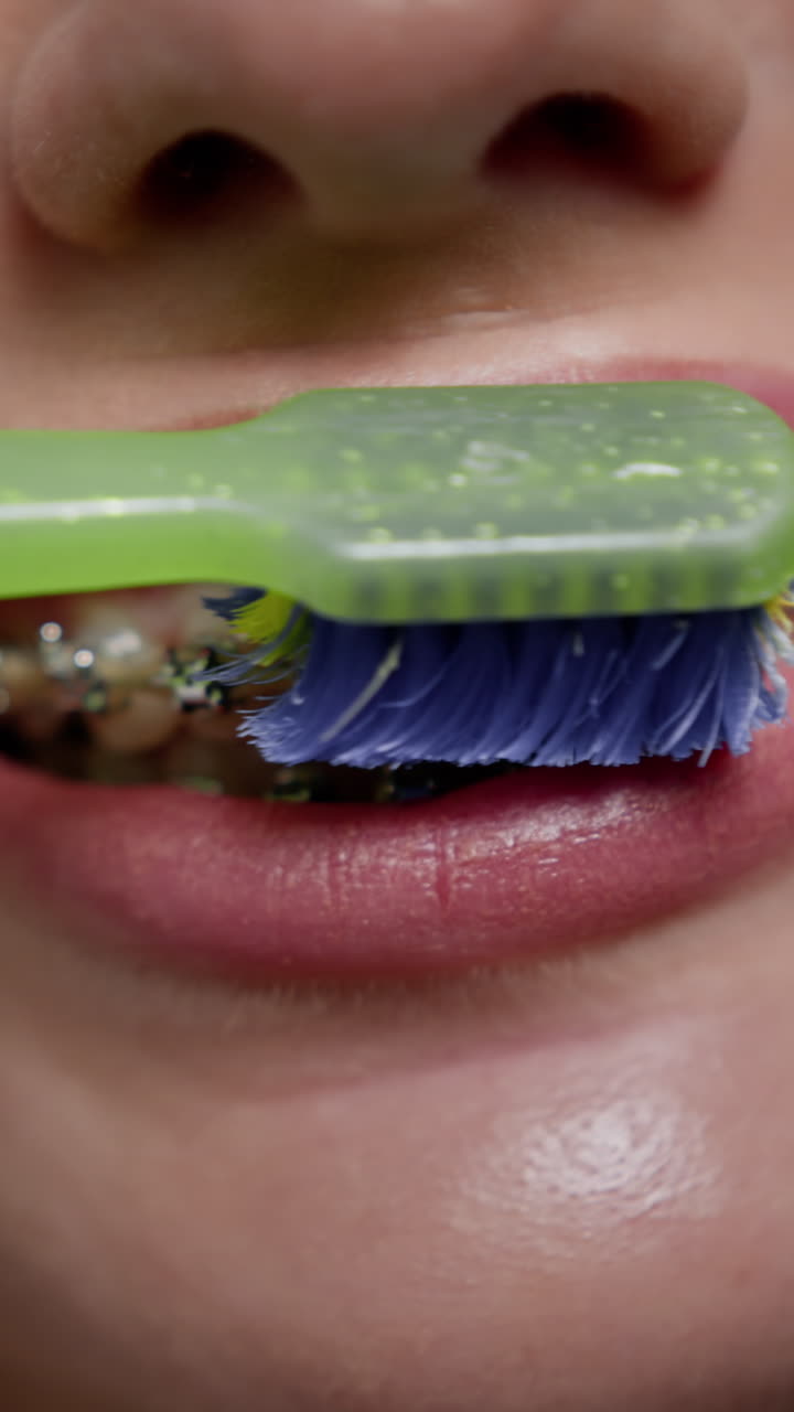 mujer con aparatos dentales cepillándose los dientes