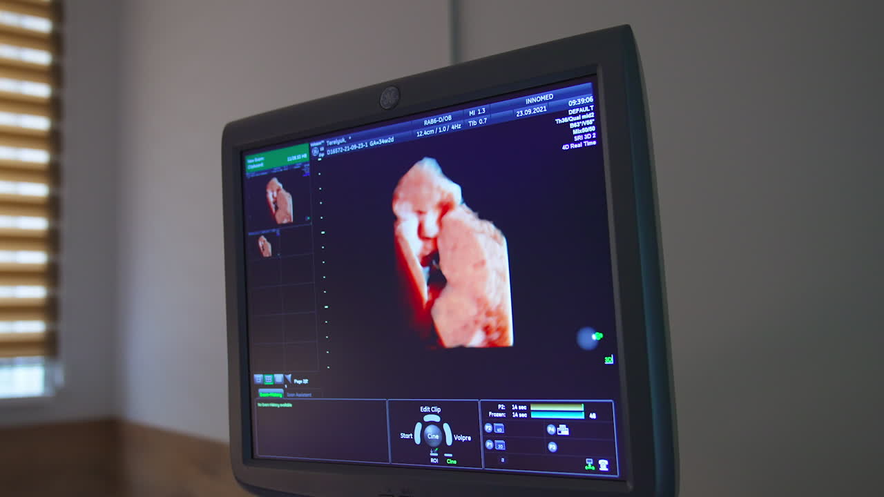Baby seen on the screen of ultrasound examination apparatus. Close up. Ultrasonic check up of pregnant woman.