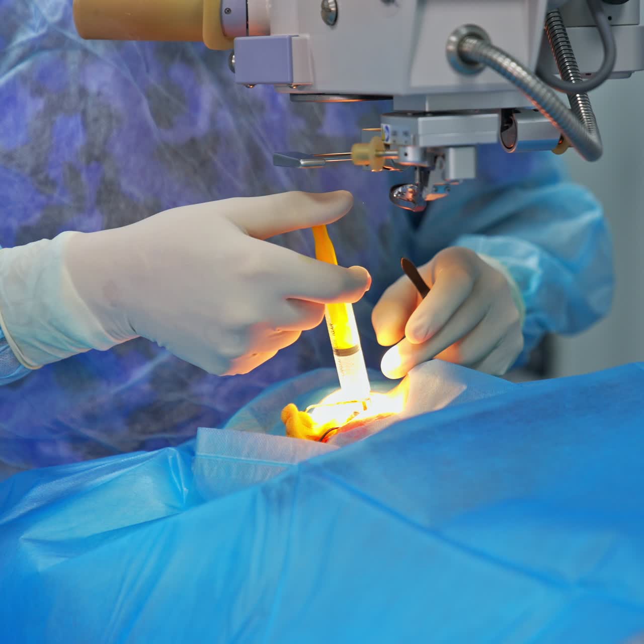 The highlighted eye of a patient at the beginning of eye surgery. Doctor uses syringe to input the anesthetic