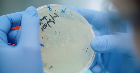 científico mirando bacterias en placa de petri en laboratorio