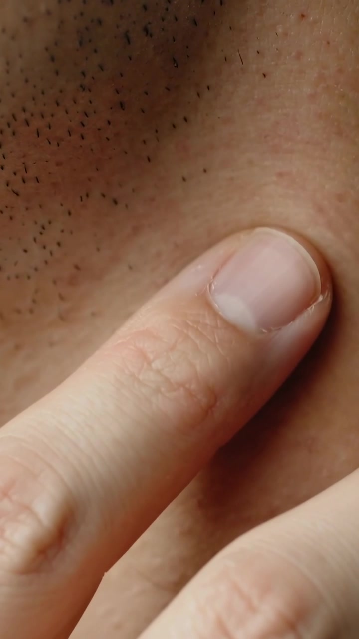 Vídeo vertical: Ponta do dedo se aproximando e tocando pescoço com barba por fazer (macro), pressionando perto da dobra com a unha.
