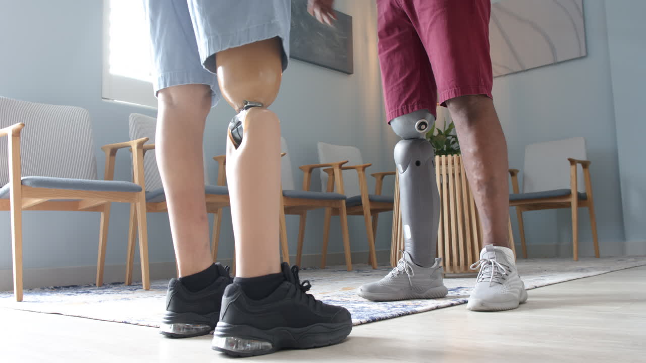 People with prosthetic legs standing and talking in modern clinic