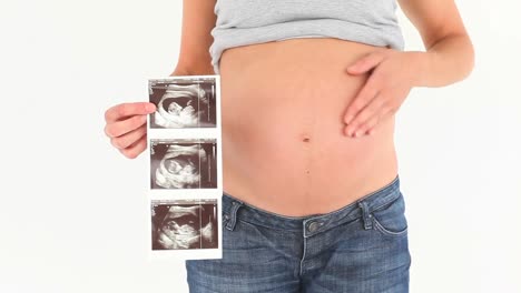 Bauch-Einer-Schwangeren-Frau-Mit-Ultraschalluntersuchung