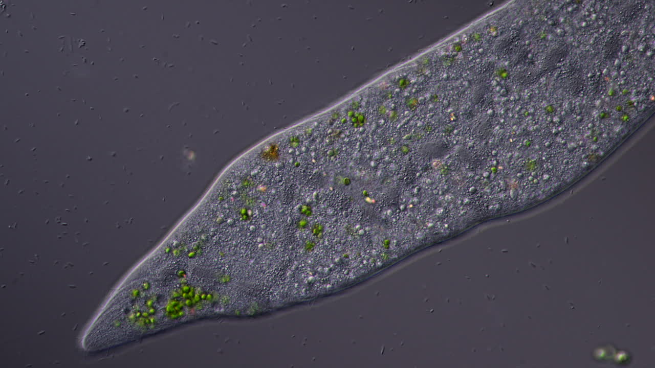 Microscopic view of a unicellular organism, possibly a Paramecium