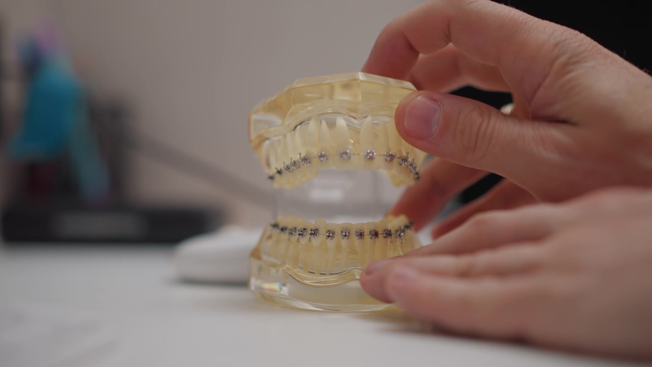 Tangan pria memanipulasi model gigi plastik bening dengan kawat gigi, menunjukkan detail perawatan ortodontik. Tampilan close-up menyoroti interaksi antara tangan manusia dan peralatan medis.