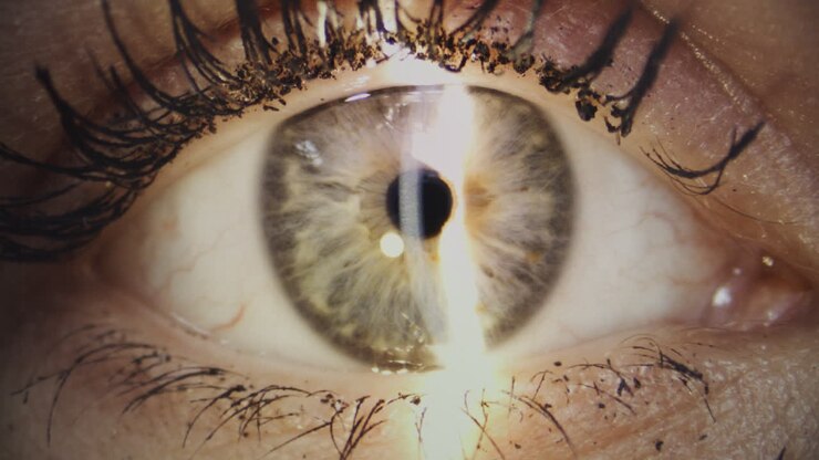Close-up van oog tijdens professioneel oogonderzoek