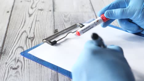 recolección de muestras de sangre para pruebas de coronavirus
