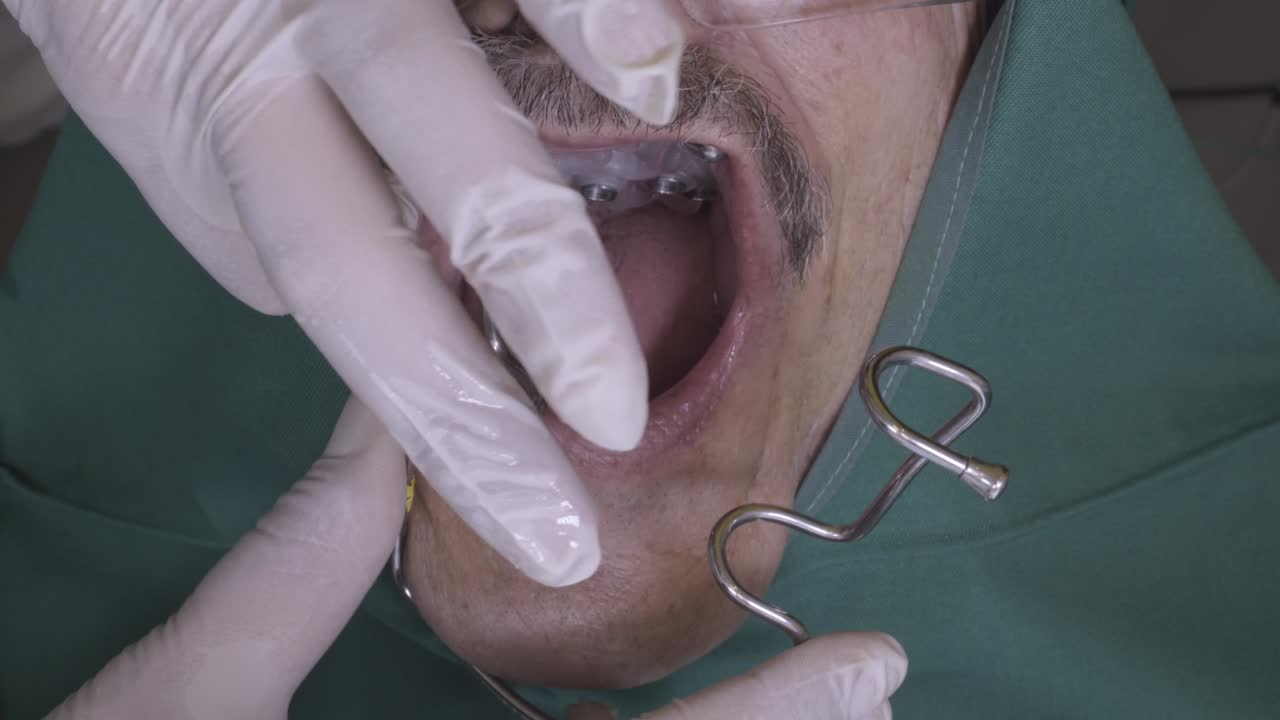 Dentist adjusting dental retractor in patient's mouth during a dental examination