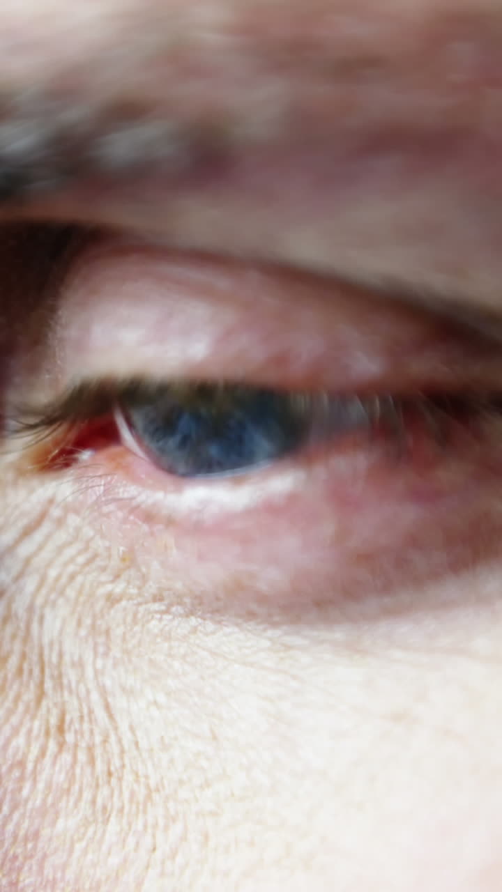 환자의 눈의 클로즈업