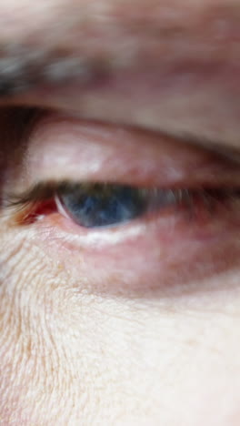 primer plano del ojo del paciente