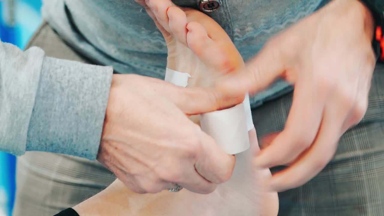 médico deportivo dando primeros auxilios al atleta durante la lesión. manos poniendo yeso